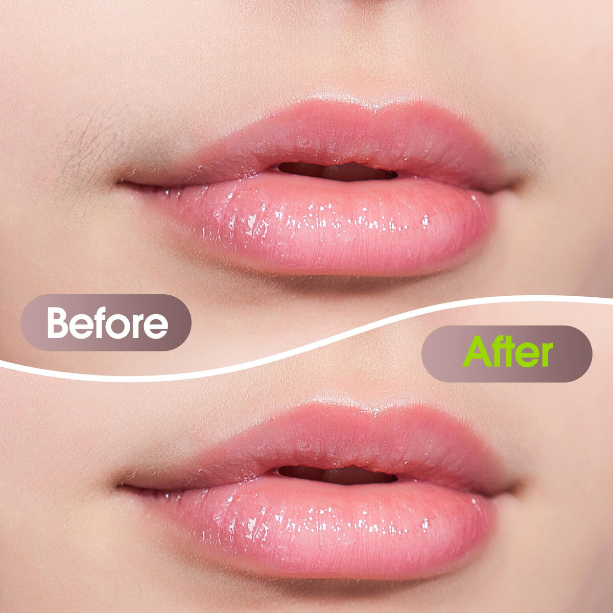 Electric Facial Hair Removal Device for Women T808130